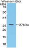 T Cell Immunoreceptor With Ig And ITIM Domains antibody, LS-C303528, Lifespan Biosciences, Western Blot image 