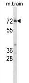 Cyclin Dependent Kinase 17 antibody, LS-C164328, Lifespan Biosciences, Western Blot image 