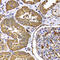 Trimethylguanosine Synthase 1 antibody, A7848, ABclonal Technology, Immunohistochemistry paraffin image 