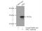 Thiamin pyrophosphokinase 1 antibody, 10942-1-AP, Proteintech Group, Immunoprecipitation image 