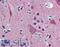 Ubiquitin C-Terminal Hydrolase L1 antibody, LS-B5981, Lifespan Biosciences, Immunohistochemistry paraffin image 