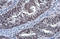Sp2 Transcription Factor antibody, GTX129030, GeneTex, Immunohistochemistry paraffin image 