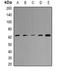 Methylcrotonoyl-CoA Carboxylase 2 antibody, orb341414, Biorbyt, Western Blot image 