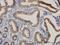 Carbamoyl-Phosphate Synthase 1 antibody, H00001373-M01, Novus Biologicals, Immunohistochemistry paraffin image 