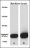 Aconitase 2 antibody, LS-B3427, Lifespan Biosciences, Western Blot image 