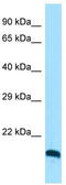 C-Type Lectin Domain Family 3 Member A antibody, TA333932, Origene, Western Blot image 