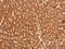 Glutathione S-Transferase Pi 1 antibody, NBP1-33627, Novus Biologicals, Immunohistochemistry paraffin image 