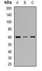 Solute Carrier Family 22 Member 8 antibody, abx141705, Abbexa, Western Blot image 
