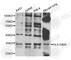 Major Histocompatibility Complex, Class II, DM Alpha antibody, A6922, ABclonal Technology, Western Blot image 