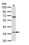 Hydroxysteroid 17-Beta Dehydrogenase 6 antibody, GTX109009, GeneTex, Western Blot image 