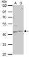 Phosphorylase Kinase Catalytic Subunit Gamma 1 antibody, NBP1-31548, Novus Biologicals, Western Blot image 