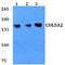 Collagen Type V Alpha 2 Chain antibody, A03869-1, Boster Biological Technology, Western Blot image 