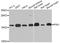 Peptidylprolyl Cis/Trans Isomerase, NIMA-Interacting 1 antibody, A2106, ABclonal Technology, Western Blot image 