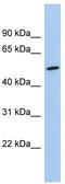 Protein naked cuticle homolog 1 antibody, TA344087, Origene, Western Blot image 