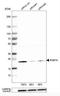 RAB7A, Member RAS Oncogene Family antibody, NBP1-87174, Novus Biologicals, Western Blot image 