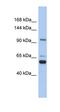 Transient Receptor Potential Cation Channel Subfamily M Member 8 antibody, orb329829, Biorbyt, Western Blot image 