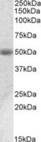 Acid Phosphatase, Prostate antibody, MBS422674, MyBioSource, Western Blot image 