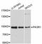 Phosphoinositide-3-Kinase Regulatory Subunit 1 antibody, A11177, ABclonal Technology, Western Blot image 