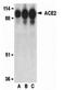 Angiotensin I Converting Enzyme 2 antibody, 19503, QED Bioscience, Western Blot image 