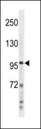 Nuclear Factor Kappa B Subunit 2 antibody, LS-C157997, Lifespan Biosciences, Western Blot image 