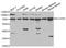 Solute carrier family 22 member 5 antibody, A1676, ABclonal Technology, Western Blot image 