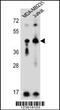 Killer Cell Immunoglobulin Like Receptor, Two Ig Domains And Long Cytoplasmic Tail 2 antibody, 62-041, ProSci, Western Blot image 