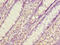 Eva-1 Homolog C antibody, LS-C375344, Lifespan Biosciences, Immunohistochemistry paraffin image 
