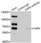 Tyrosyl-TRNA Synthetase antibody, LS-C335705, Lifespan Biosciences, Immunoprecipitation image 