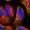 Phosphorylase Kinase Regulatory Subunit Alpha 1 antibody, HPA001081, Atlas Antibodies, Immunocytochemistry image 