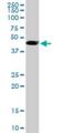 Transcriptional Adaptor 2B antibody, H00093624-M08, Novus Biologicals, Western Blot image 