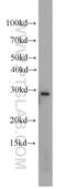 Proteasome Subunit Alpha 8 antibody, 14022-1-AP, Proteintech Group, Western Blot image 