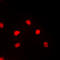 Myocyte Enhancer Factor 2C antibody, LS-C356188, Lifespan Biosciences, Immunofluorescence image 