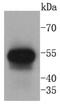 Keratin 13 antibody, NBP2-67689, Novus Biologicals, Western Blot image 