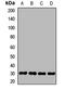 SRP Receptor Subunit Beta antibody, LS-C668593, Lifespan Biosciences, Western Blot image 