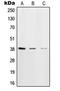 DNA Polymerase Beta antibody, LS-C352683, Lifespan Biosciences, Western Blot image 