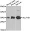 Sulfotransferase Family 1E Member 1 antibody, abx006963, Abbexa, Western Blot image 