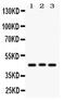 Ataxin 3 antibody, PA5-78848, Invitrogen Antibodies, Western Blot image 