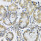 Mitochondrial Ribosomal Protein L1 antibody, A4947, ABclonal Technology, Immunohistochemistry paraffin image 