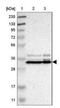 Serine protease inhibitor Kazal-type 5 antibody, NBP1-90509, Novus Biologicals, Western Blot image 