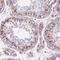 Post-GPI Attachment To Proteins 1 antibody, NBP2-38121, Novus Biologicals, Immunohistochemistry paraffin image 