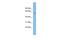 Inositol-Pentakisphosphate 2-Kinase antibody, PA5-44818, Invitrogen Antibodies, Western Blot image 