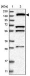 Kinesin Family Member 1C antibody, PA5-55119, Invitrogen Antibodies, Western Blot image 