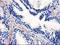 Peroxisome Proliferator Activated Receptor Alpha antibody, LS-C337492, Lifespan Biosciences, Immunohistochemistry frozen image 