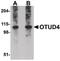 OTU Deubiquitinase 4 antibody, PA5-20707, Invitrogen Antibodies, Western Blot image 