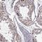 Checkpoint with forkhead and RING finger domains protein antibody, NBP2-68970, Novus Biologicals, Immunohistochemistry frozen image 
