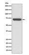 TNF Receptor Superfamily Member 1B antibody, M01437, Boster Biological Technology, Western Blot image 