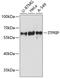 Inositol 1,4,5-Trisphosphate Receptor Interacting Protein antibody, GTX64948, GeneTex, Western Blot image 