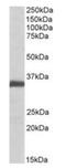 Ephrin B2 antibody, orb20621, Biorbyt, Western Blot image 