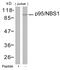 Nibrin antibody, GTX50412, GeneTex, Western Blot image 
