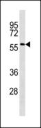 Acyl-CoA Synthetase Family Member 2 antibody, LS-C203849, Lifespan Biosciences, Western Blot image 